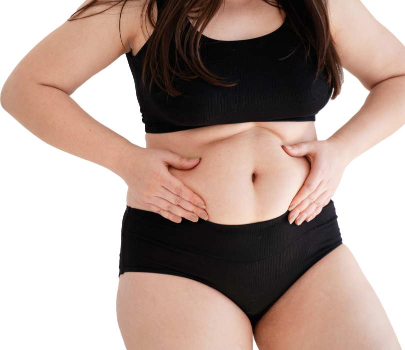 Стомашен балон