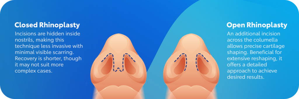 kapalı-ve-açık-burun-estetiği